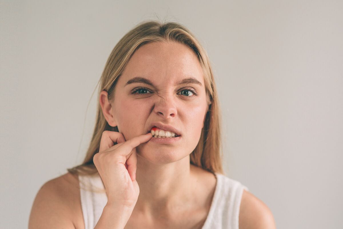 Gingivitis: Symptoms, Causes & Treatment Guide (2026)