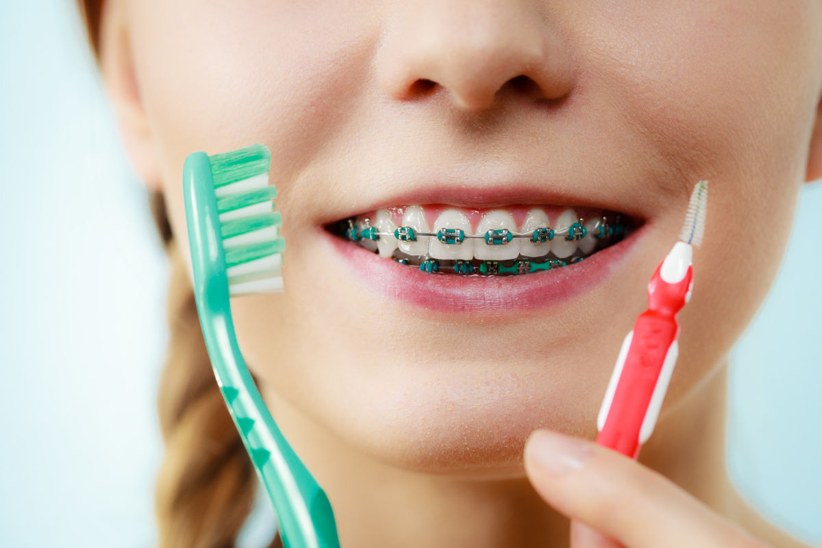 How to Brush Teeth With Braces: Complete Oral Hygiene Guide (2026)