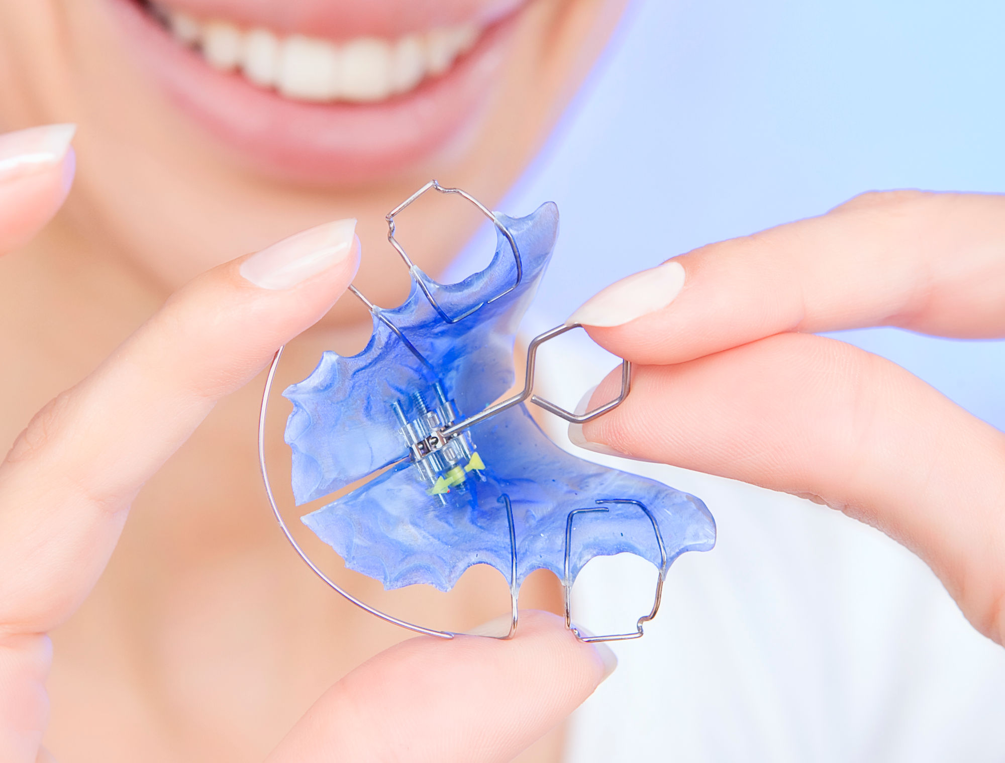 Night-Only Aligners: Do They Work? Pros, Cons & Alternatives (2026)