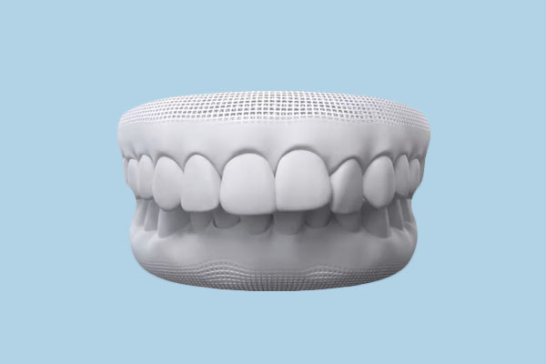 Overbite Correction in 2026: Treatment Options, Costs & What to Expect