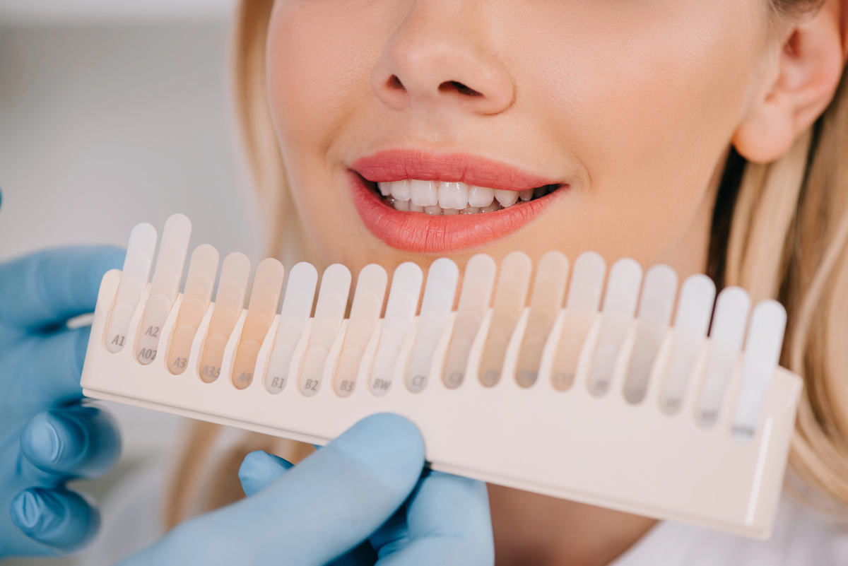 Teeth Whitening Cost in 2026: NYC Prices for Every Method Compared