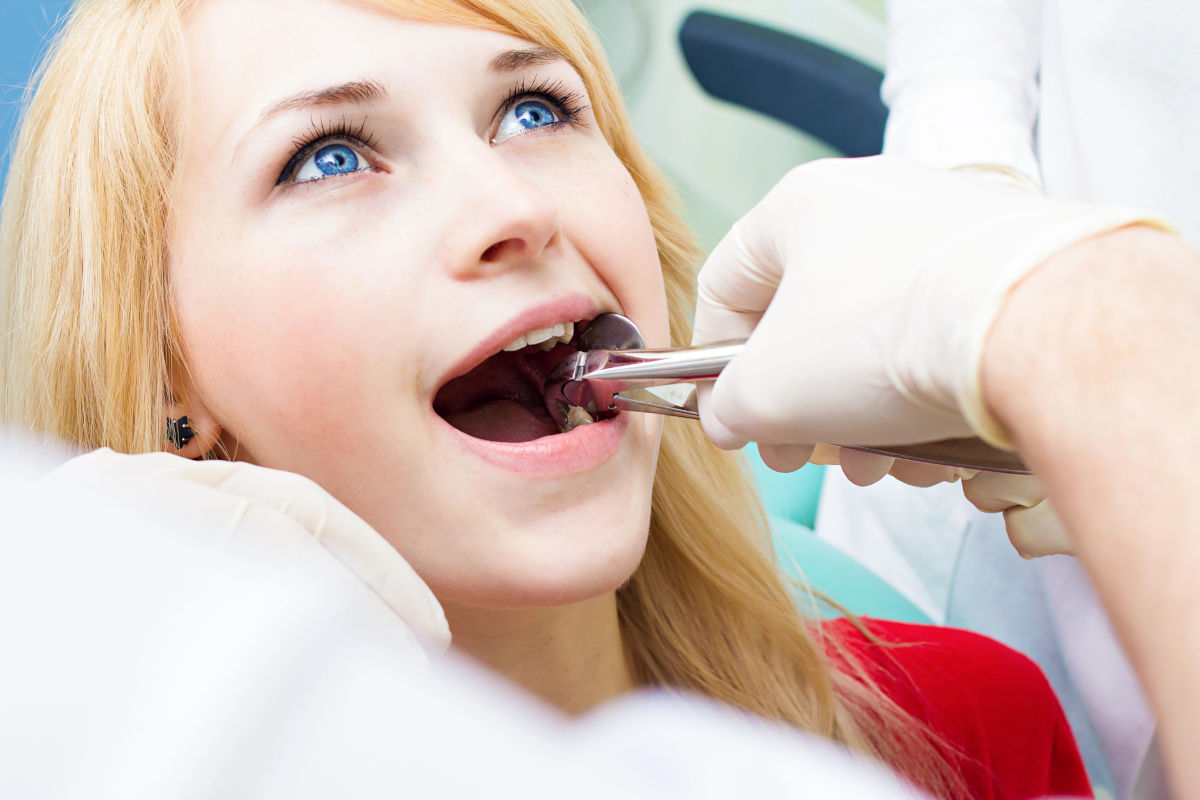Tooth Extraction: Procedure, Recovery, Cost & Aftercare (2026 Guide)